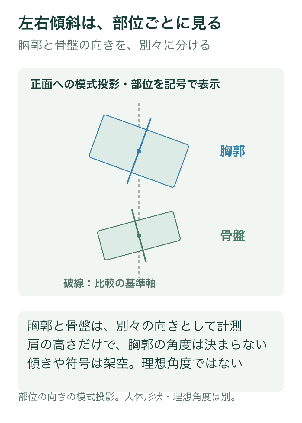 正面への模式投影で胸郭と骨盤を別々のブロックとして描き、共通の鉛直基準と各ブロックの傾いた局所軸を示す。